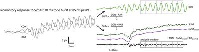 Putative Auditory-Evoked Neurophonic Measurements Using a Novel Signal Processing Technique: A Pilot Case Study